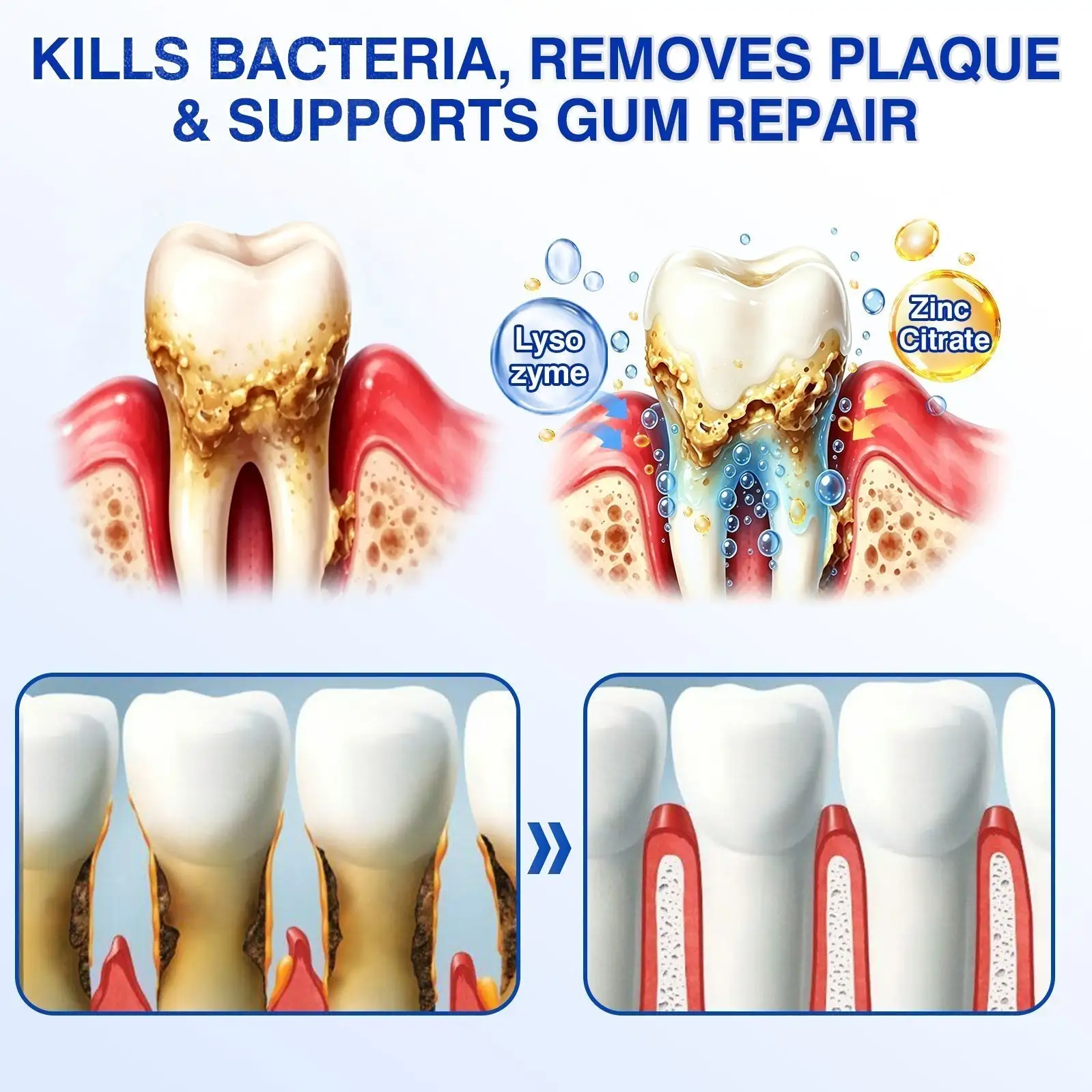 GumRevive Periodontal Repair Gel - Image 6