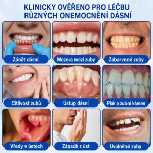 🇨🇿 🦷 GumRevive parodontální opravný gel🥚 - Image 8