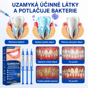 🇨🇿 🦷 GumRevive parodontální opravný gel🥚 - Image 9