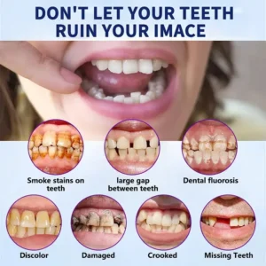🦷Premium Advanced Customized Full Denture Set 👑 (⏰Limited time discount last 30 minutes) - Image 9