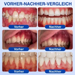 GumRevive Zahnfleisch- Regenerationsgel - Image 3