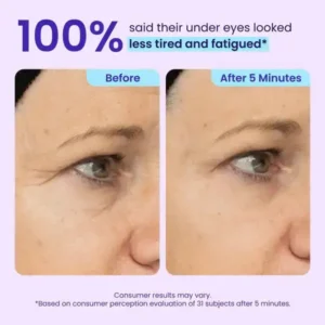 Eye Bag Instant Eraser - Image 2