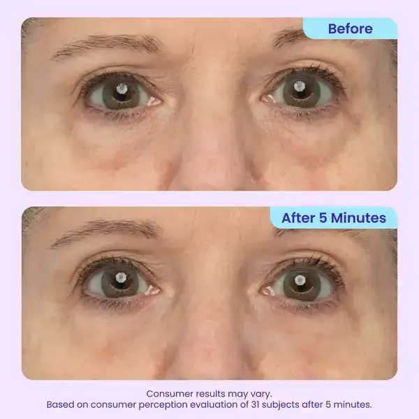 Eye Bag Instant Eraser - Image 4