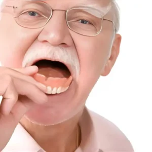 – Full Denture Set - Image 5