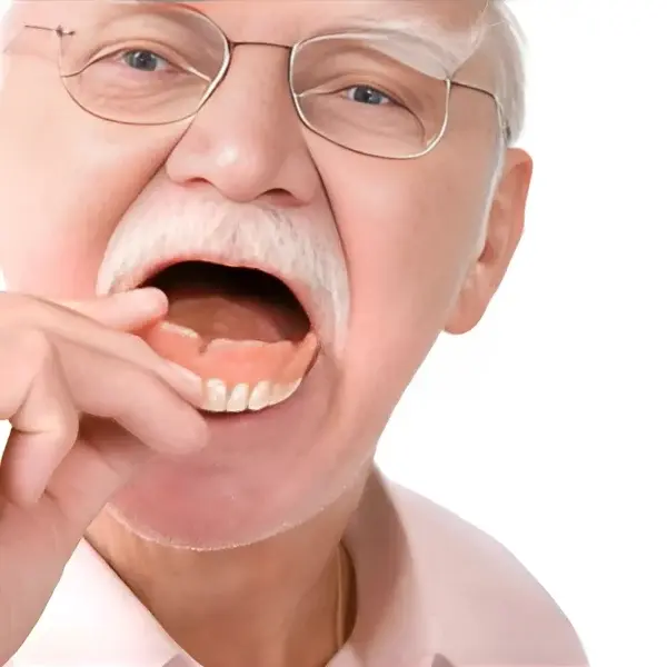 – Full Denture Set - Image 5
