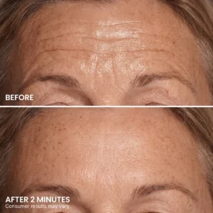 Instant Eye Tightener - Image 6