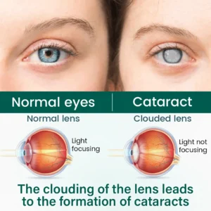 OptiClear Nano Eye Roller Serum - Image 4