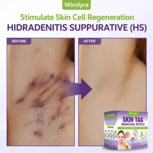Soluble Microneedle Botanical Skin Tag Removal Patch - Image 7