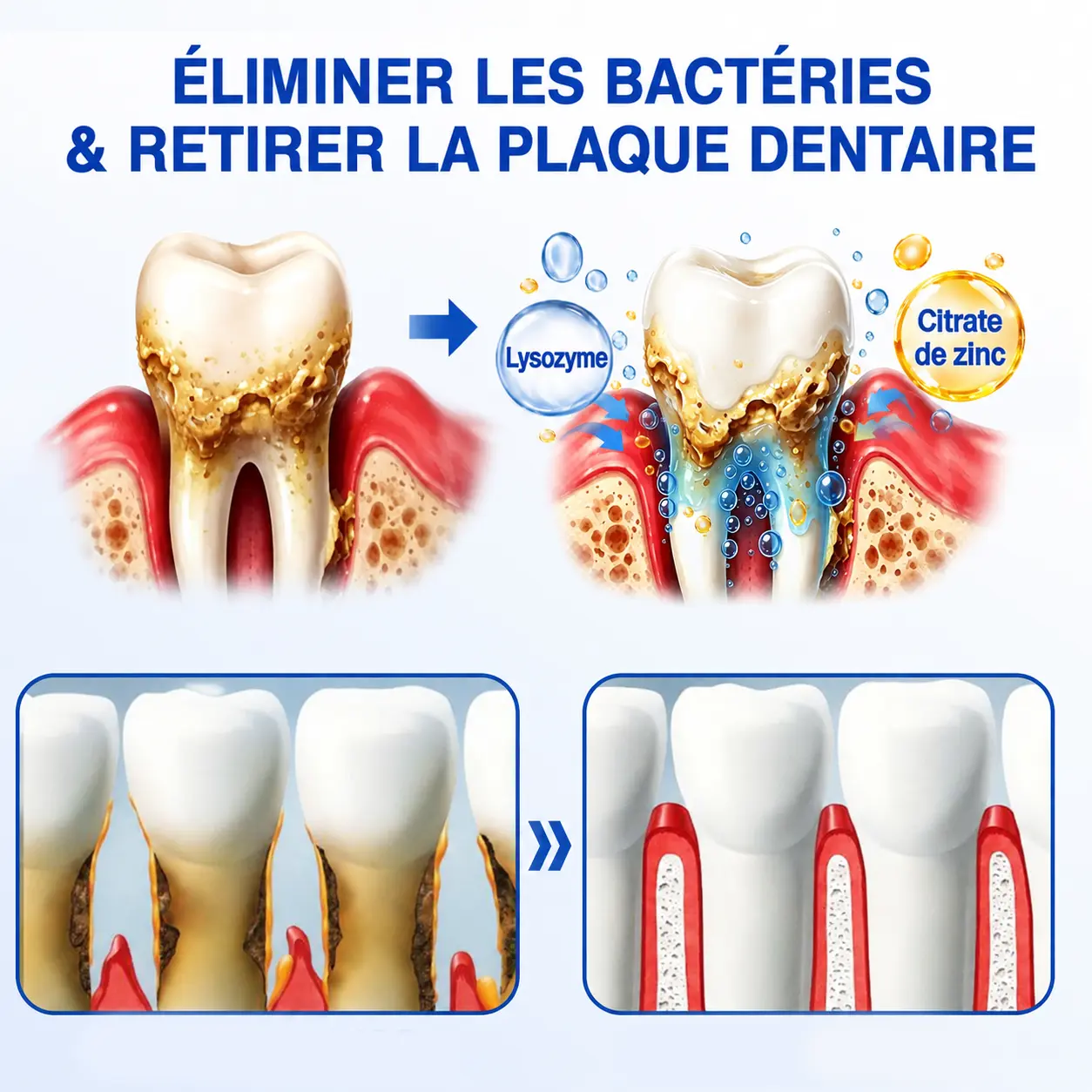 Glimmerly GumRevive - Gel de Réparation Parodontale - Image 8