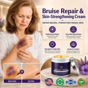 Bruise Repair Cream