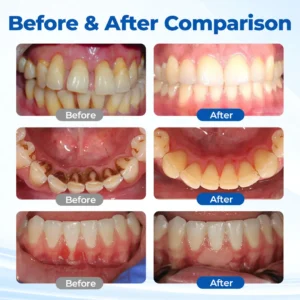 Periodontal Recovery Gel - Image 2