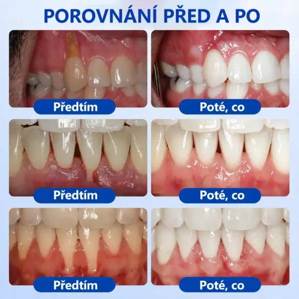 GumRevive - Image 11