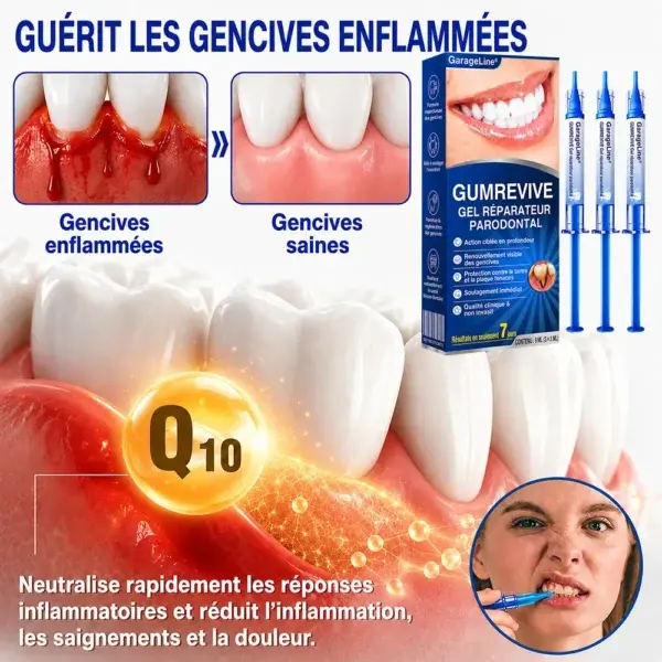 Gel Parodontal - Image 10