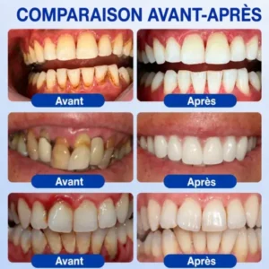 Gel Parodontal - Image 12