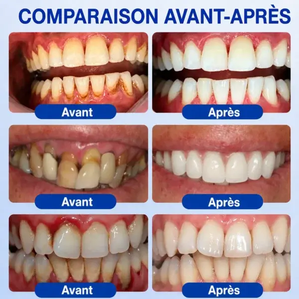 Gel Parodontal - Image 12