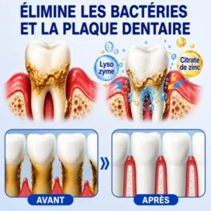 Gel Parodontal - Image 8