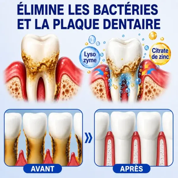 Gel Parodontal - Image 8