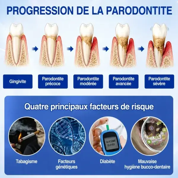 Gel Régénération Parodontale - Image 4
