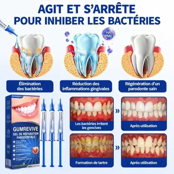 Gel Régénération Parodontale - Image 8