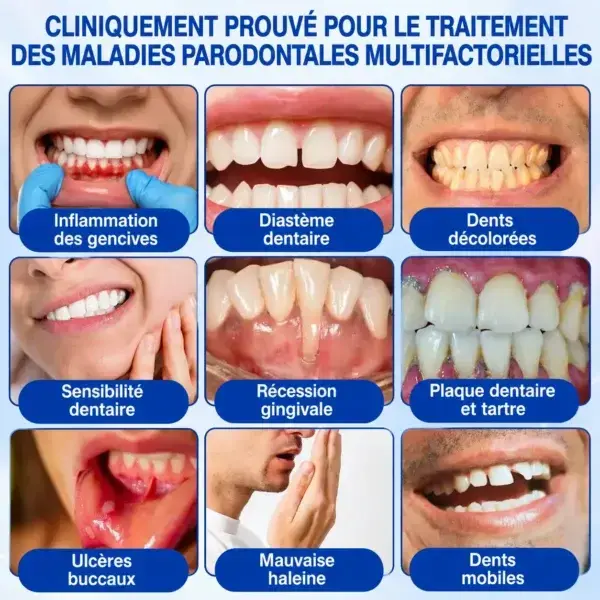 Gel Régénération Parodontale - Image 6
