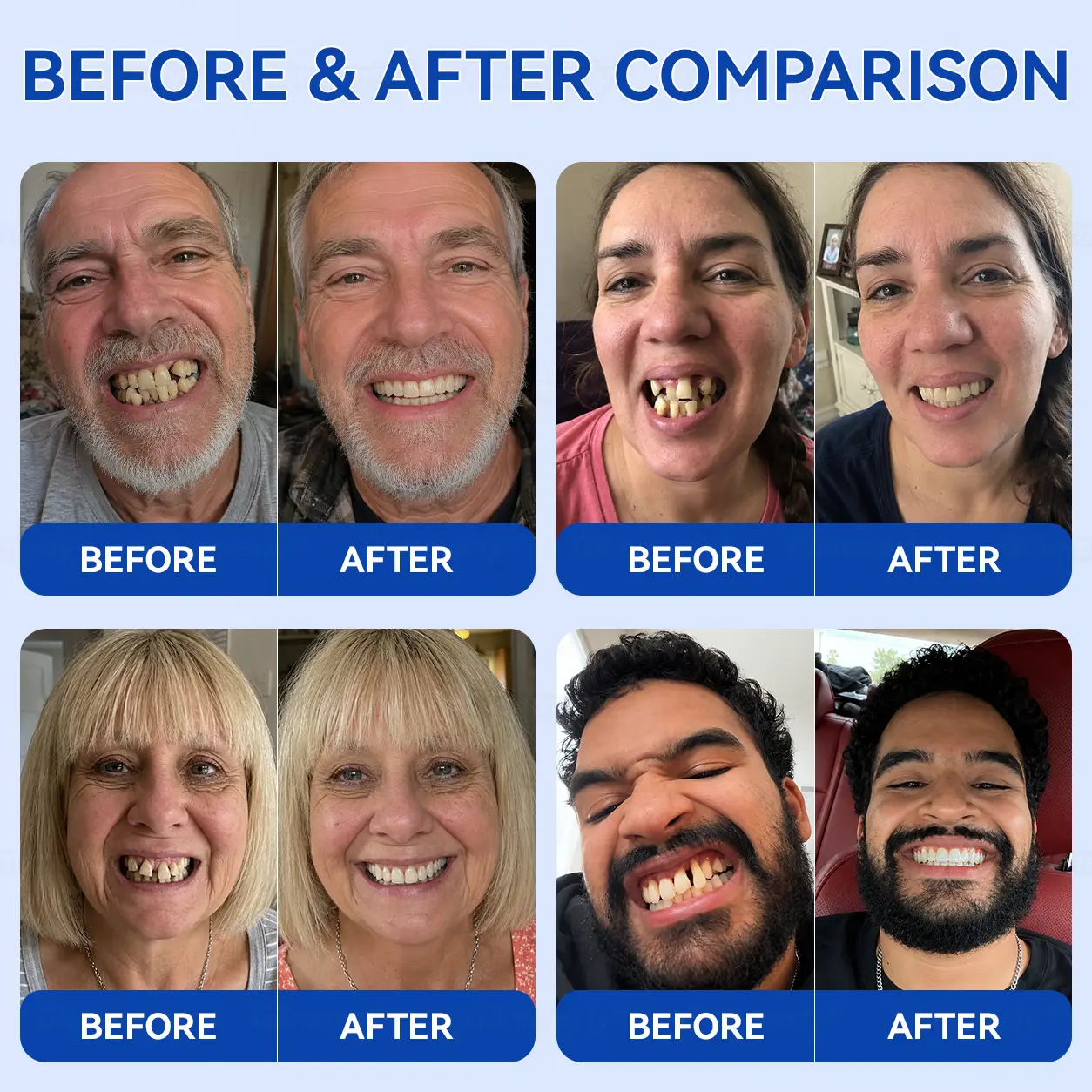 GumRevive Periodontal Repair Gel - Image 3