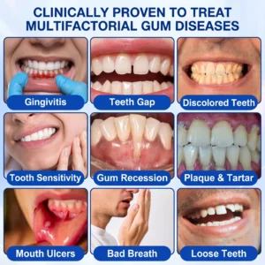 GumRevive Periodontal Repair Gel - Image 5