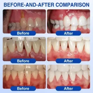 Periodontal Gel - Image 2