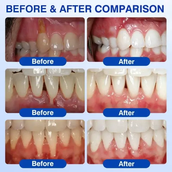 GumVital Advanced Gum Care Gel - Image 15