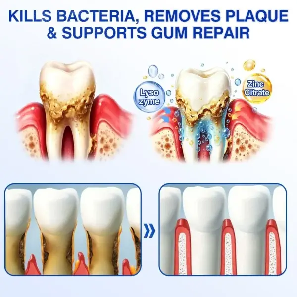 GumVital Advanced Gum Care Gel - Image 17