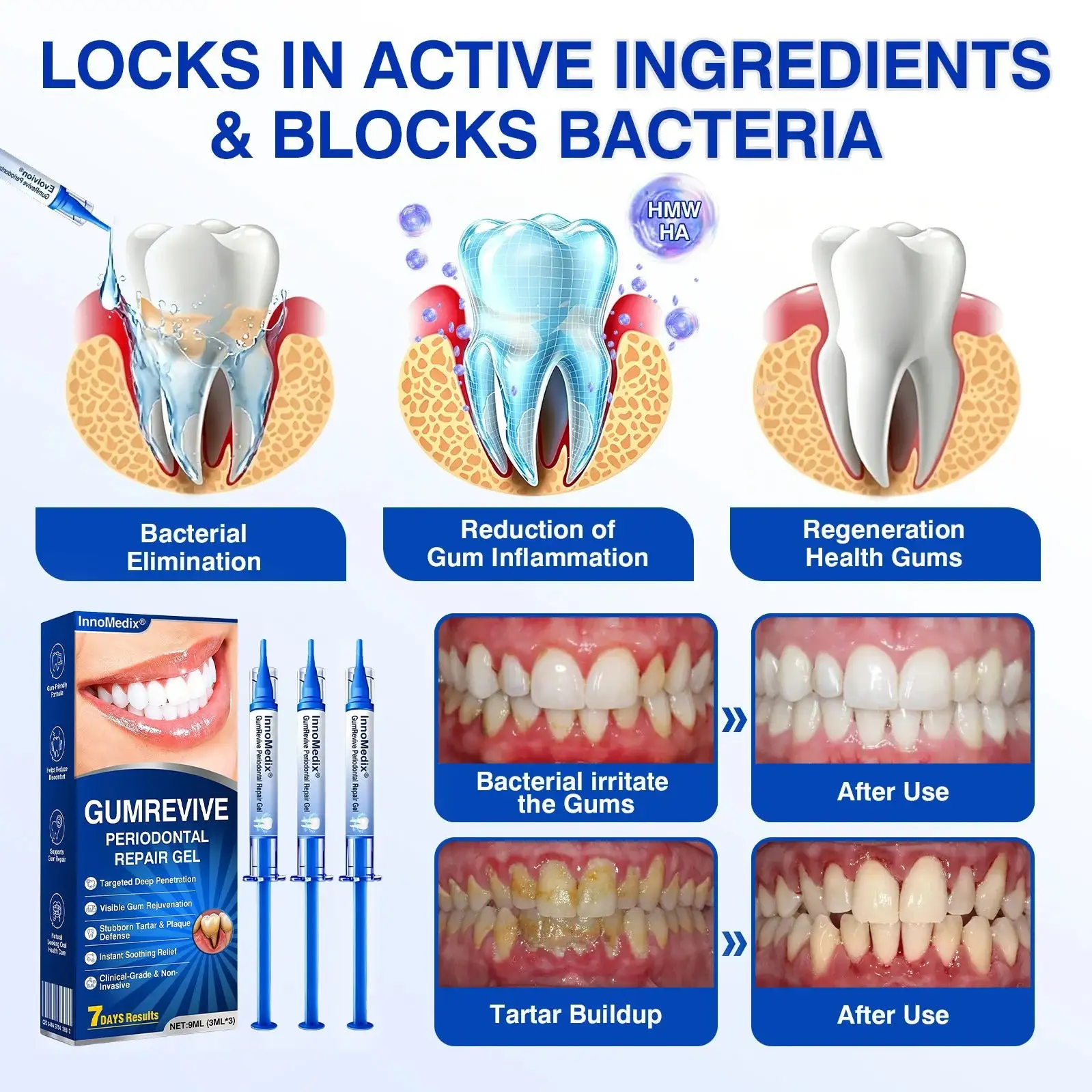 GumRevive Periodontal Repair Gel - Image 3