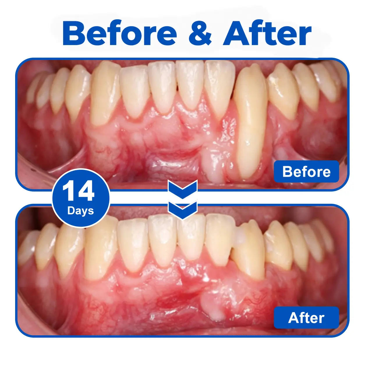 GumRevive - Image 4