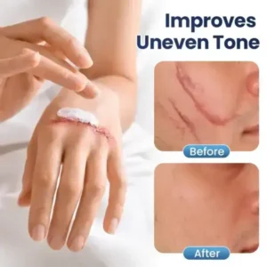 Texture Repair Gel - Image 6