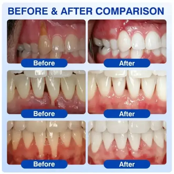 Periodontal Care Gel - Image 5