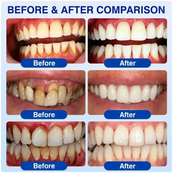 Periodontal Care Gel - Image 6