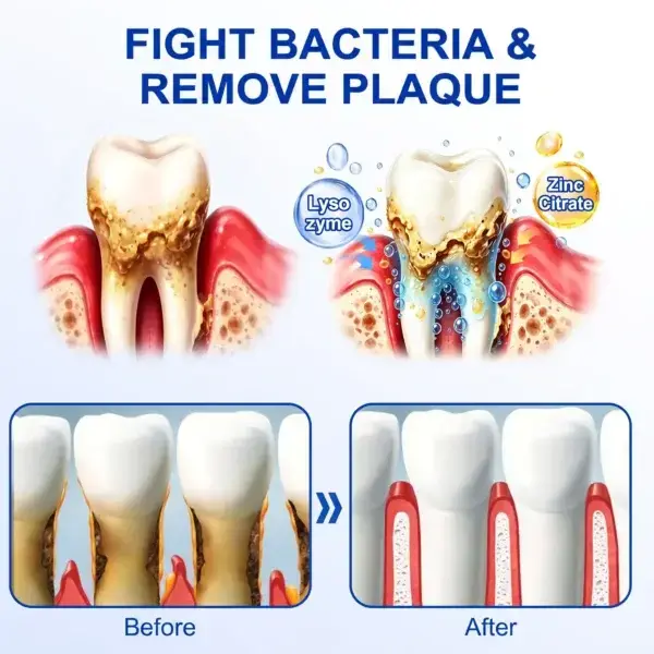 GumRevive Periodontal Repair Gel - Image 12