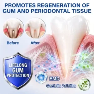 GumRevive Periodontal Repair Gel - Image 13