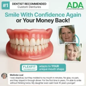 Custom-Fit Full Dentures