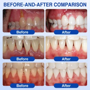 Gum Revive - Image 3
