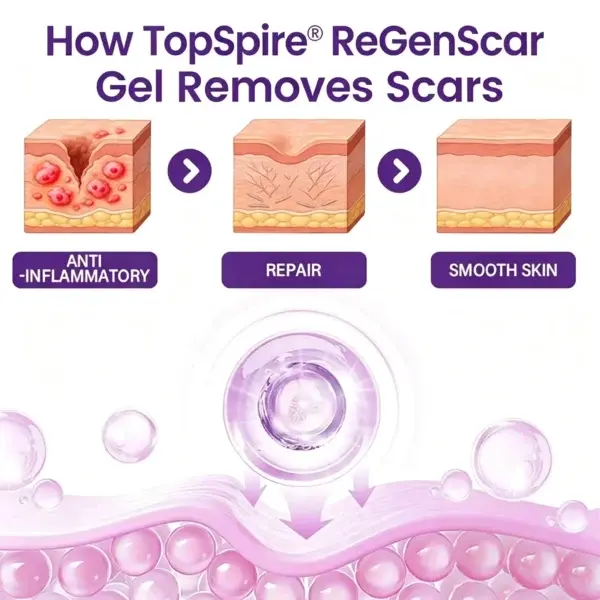 Scar Gel - Image 2