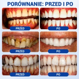 GumRevive - Image 4
