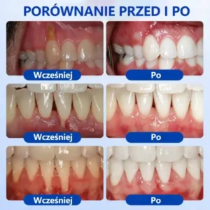 𝑮𝒖𝒎𝑹𝒆𝒗𝒊𝒗𝒆 Ż𝒆𝒍 𝒅𝒐 𝒓𝒆𝒈𝒆𝒏𝒆𝒓𝒂𝒄𝒋𝒊 𝒅𝒛𝒊ą𝒔𝒆ł - Image 3
